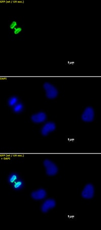 Histone H3 phospho Ser10 mAb tested by immunofluorescence. Staining of HeLa cells with Histone H3 phospho Ser10 mAb (1 ug/ml, top panel) and DAPI (middle panel), and a merge of both images (bottom panel). Histone H3 phospho Ser10 mAb tested by immunofluorescence. Staining of HeLa cells with Histone H3 phospho Ser10 mAb (1 ug/ml, top panel) and DAPI (middle panel), and a merge of both images (bottom panel).