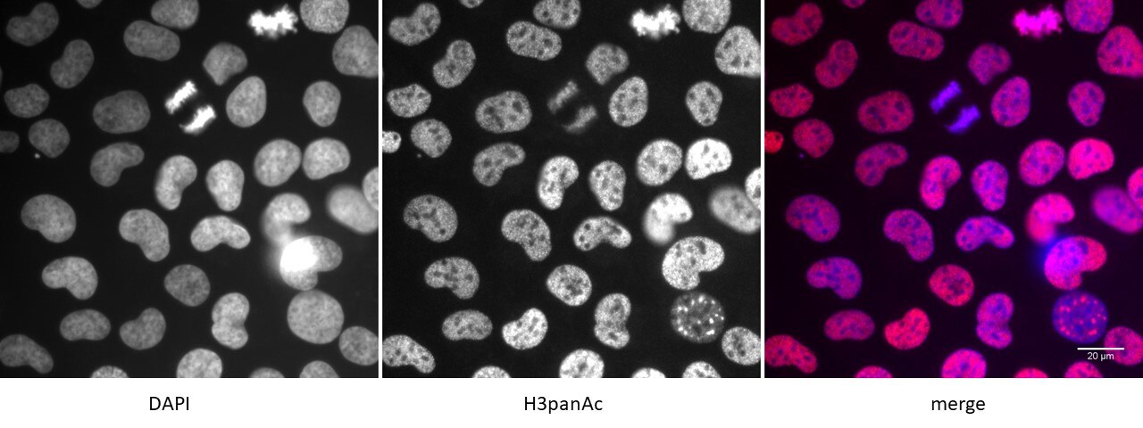 Detection of H3panAc by immunofluorescence. U2OS cells were stained with H3panAc antibody at a dilution of 1:500. Left panel: DAPI. Middle panel: Histone H3 pan-acetyl antibody staining. Right panel: merge. Detection of H3panAc by immunofluorescence. U2OS cells were stained with H3panAc antibody at a dilution of 1:500. Left panel: DAPI. Middle panel: Histone H3 pan-acetyl antibody staining. Right panel: merge.