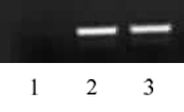 Histone H4 acetyl Lys5 antibody tested by ChIP analysis. Chromatin IP performed on HeLa cell chromatin using 39169. PCR was performed using primers specific for the promoter region of the human GAPDH gene. Lane 1: negative IgG control. Lane 2: ChIP using 10 ul of 39169. Lane 3: Input DNA control.