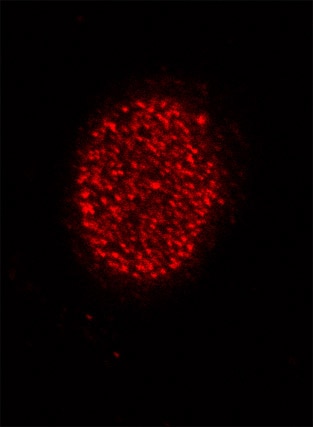 Histone H4 acetyl Lys5 antibody tested by immunofluorescence. Staining of HeLa cells with Histone H4 acetyl Lys5 antibody (1:500 dilution, top panel) and DAPI (bottom panel).