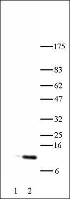Histone H4 acetyl Lys5 antibody tested by Western blot. HeLa acid extract probed with Histone H4 acetyl Lys5 polyclonal antibody (1:1,000 dilution). Lane 1: No treatment. Lane 2: Cells treated with sodium butyrate.