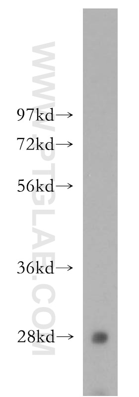 WB analysis of mouse liver using 51060-1-Ig