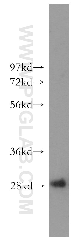 Western Blot (WB) analysis of human liver tissue using Hepsin Polyclonal antibody (51060-1-Ig)