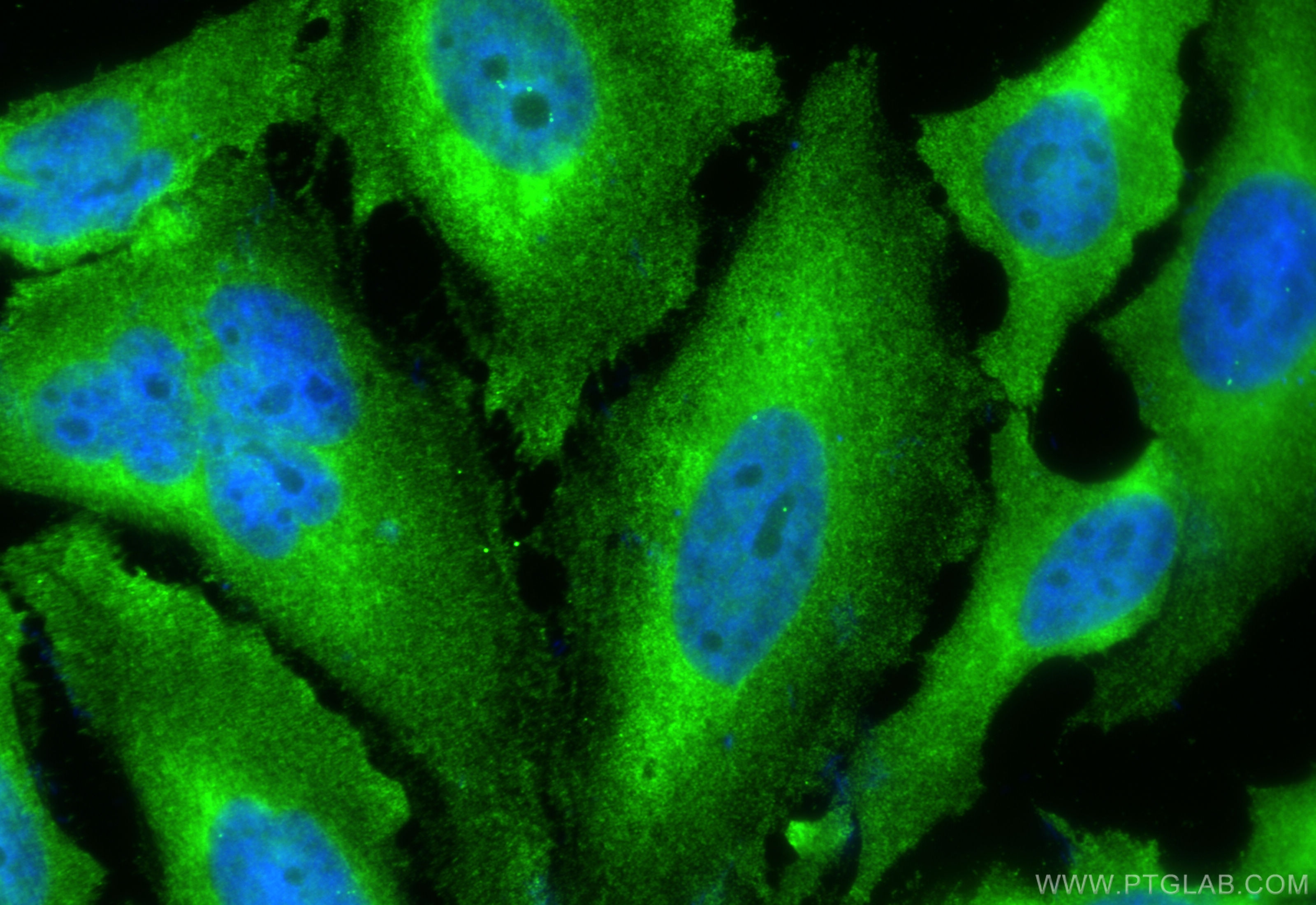 Immunofluorescence (IF) / fluorescent staining of HeLa cells using Hsc70 Monoclonal antibody (66442-1-Ig)