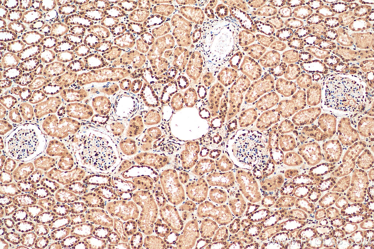 Immunohistochemistry (IHC) staining of human kidney tissue using HuR/ELAVL1 Polyclonal antibody (11910-1-AP)
