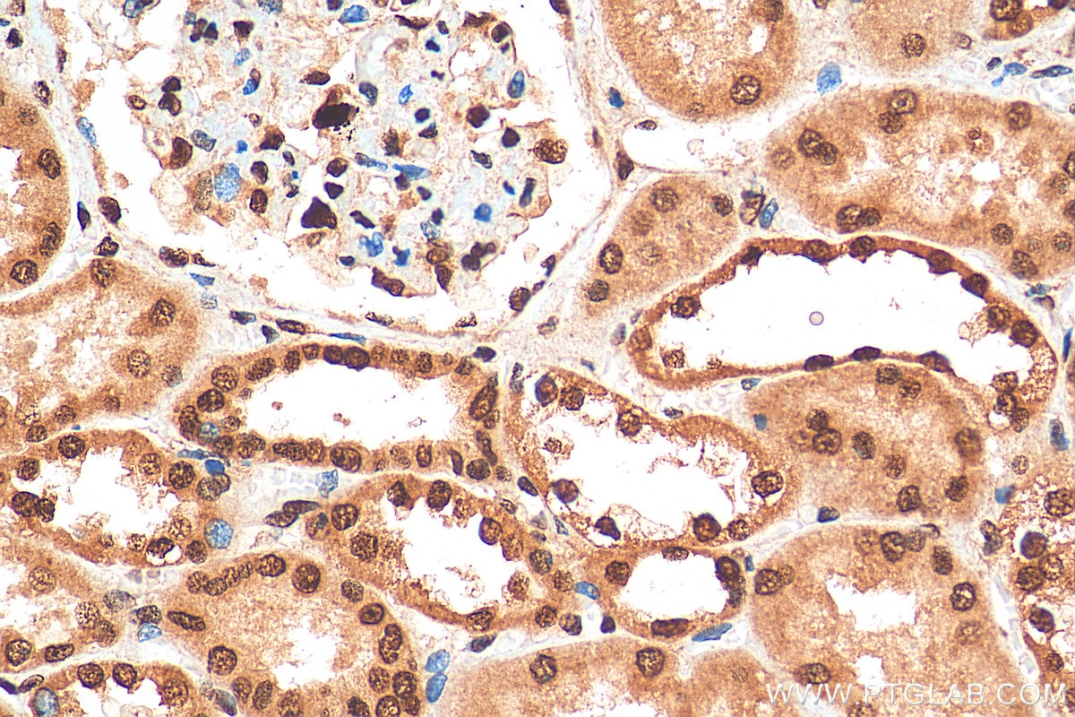 Immunohistochemistry (IHC) staining of human kidney tissue using HuR/ELAVL1 Polyclonal antibody (11910-1-AP)