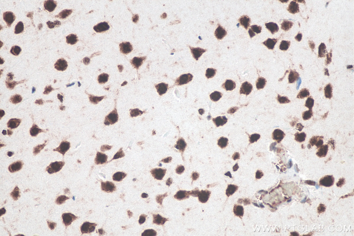 IHC staining of rat brain using 66549-1-Ig Immunohistochemistry (IHC) staining of rat brain tissue using HuR/ELAVL1 Monoclonal antibody (66549-1-Ig)