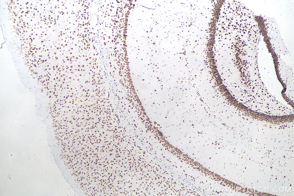 IHC staining of mouse brain using 66549-1-Ig Immunohistochemistry (IHC) staining of mouse brain tissue using HuR/ELAVL1 Monoclonal antibody (66549-1-Ig)