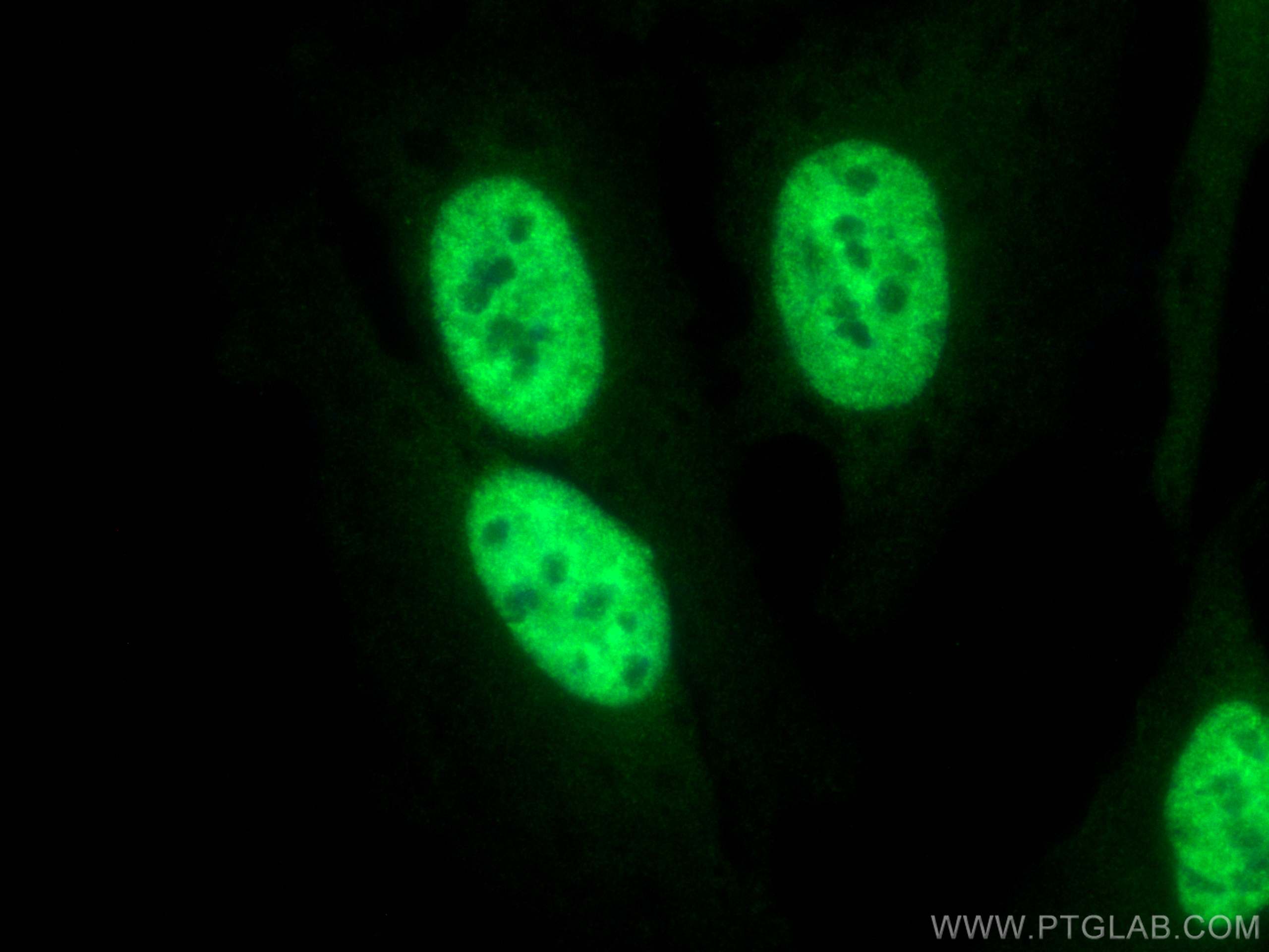 IF Staining of HeLa using CL488-11910