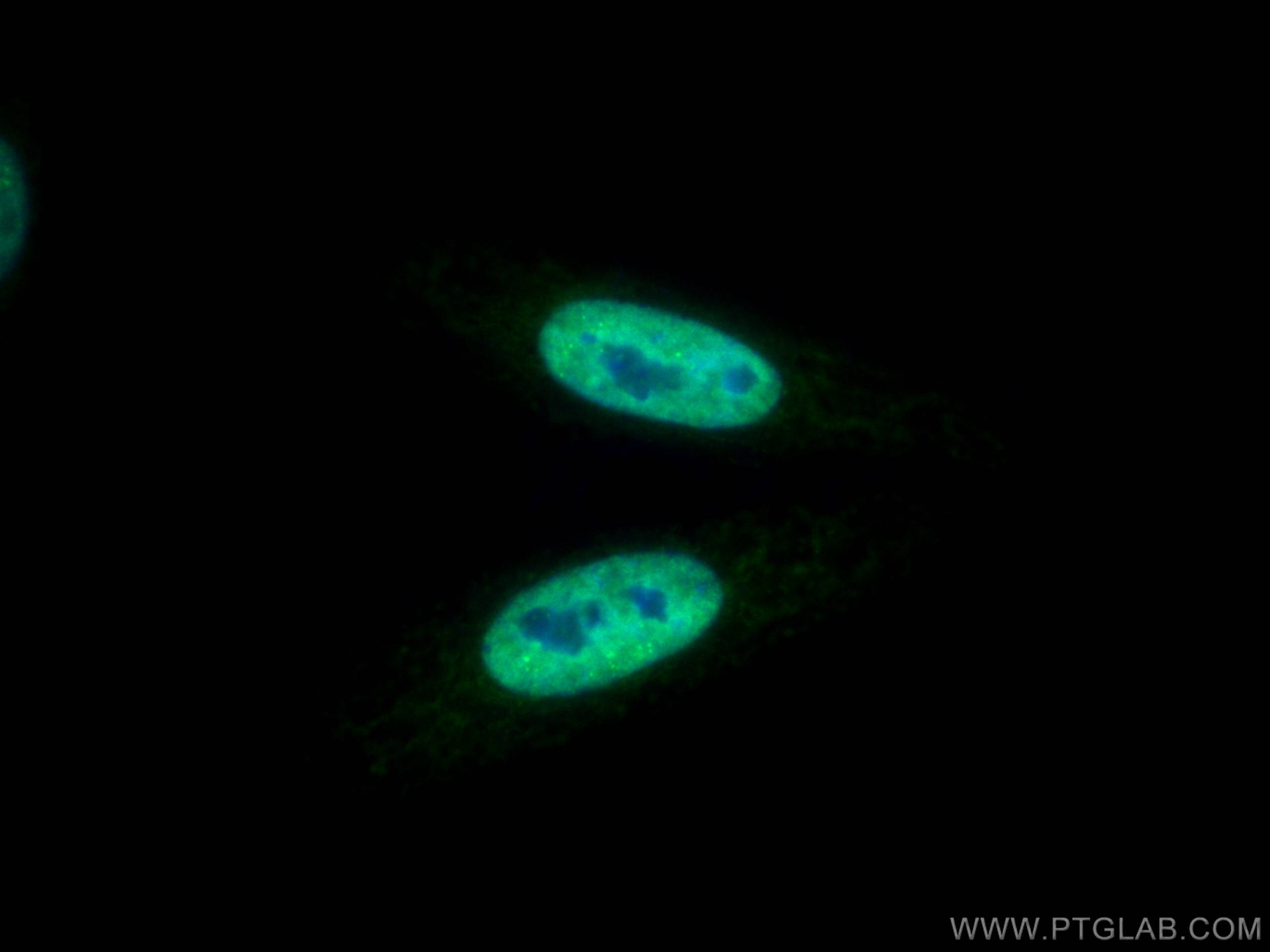 IF Staining of HepG2 using CL488-66549