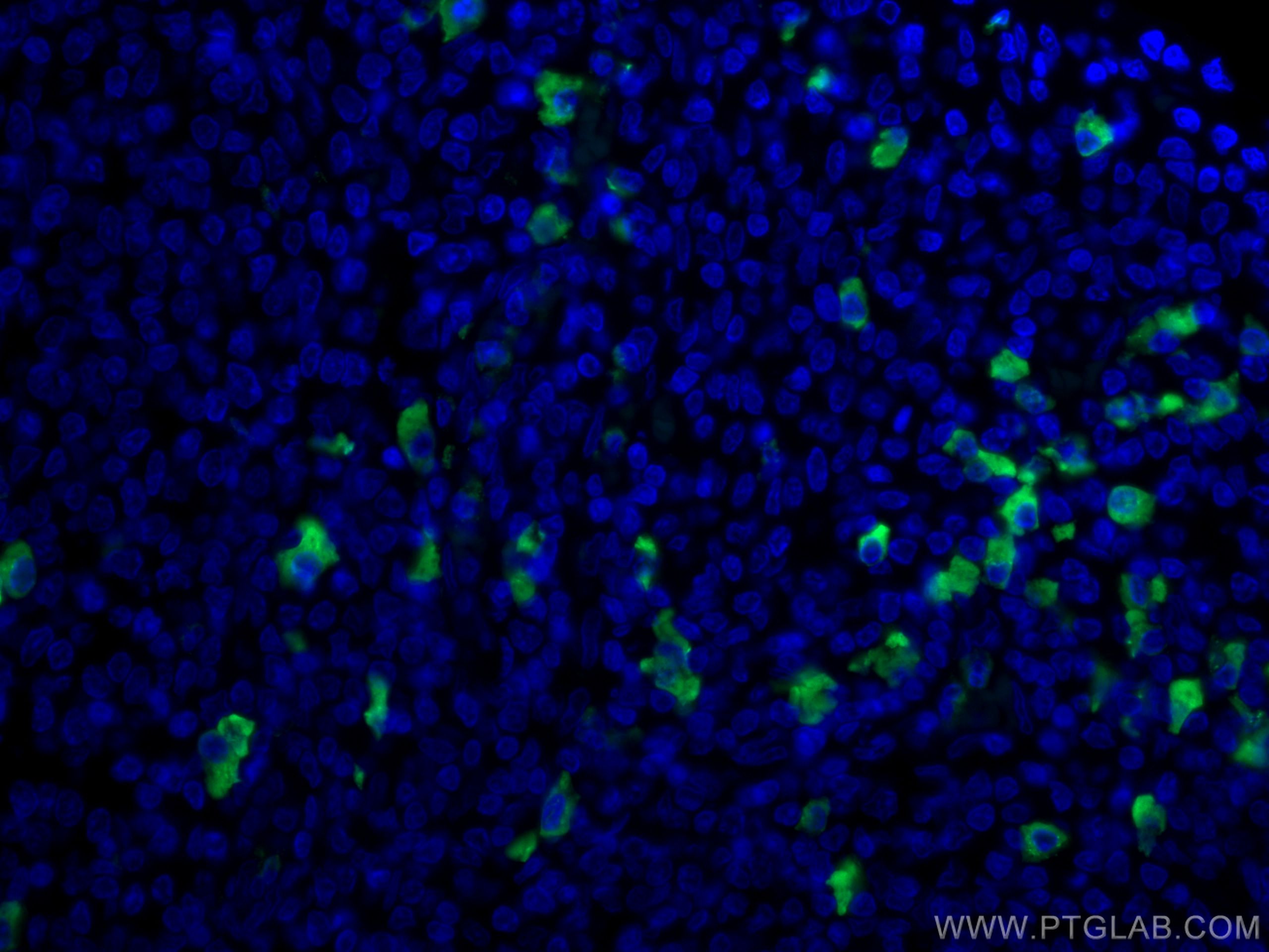 Immunofluorescence (IF) / fluorescent staining of human tonsillitis tissue using CoraLite® Plus 488-conjugated Human IgA Monoclonal (CL488-60099)