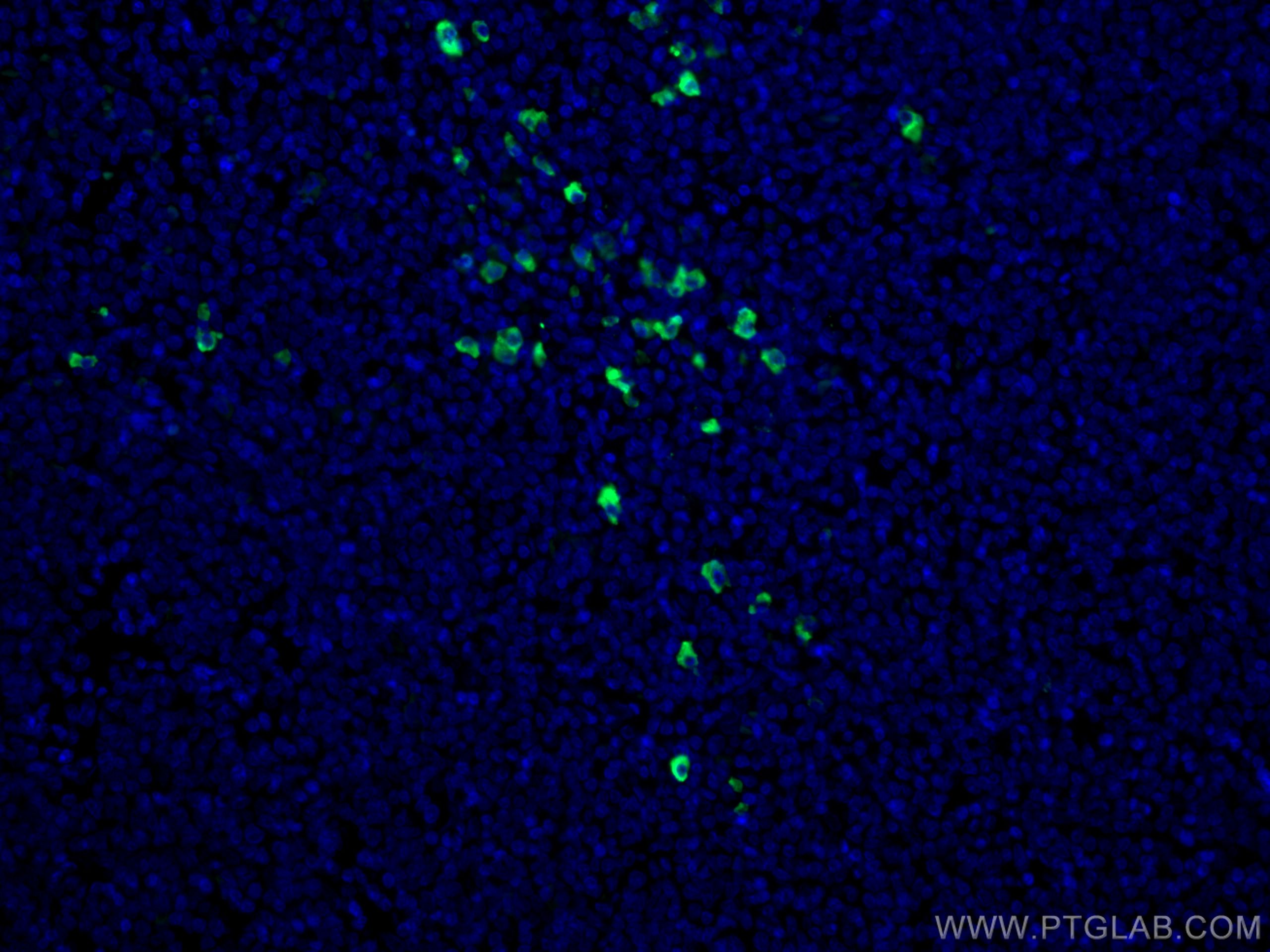 Immunofluorescence (IF) / fluorescent staining of human tonsillitis tissue using CoraLite® Plus 488-conjugated Human IgA Monoclonal (CL488-60099)