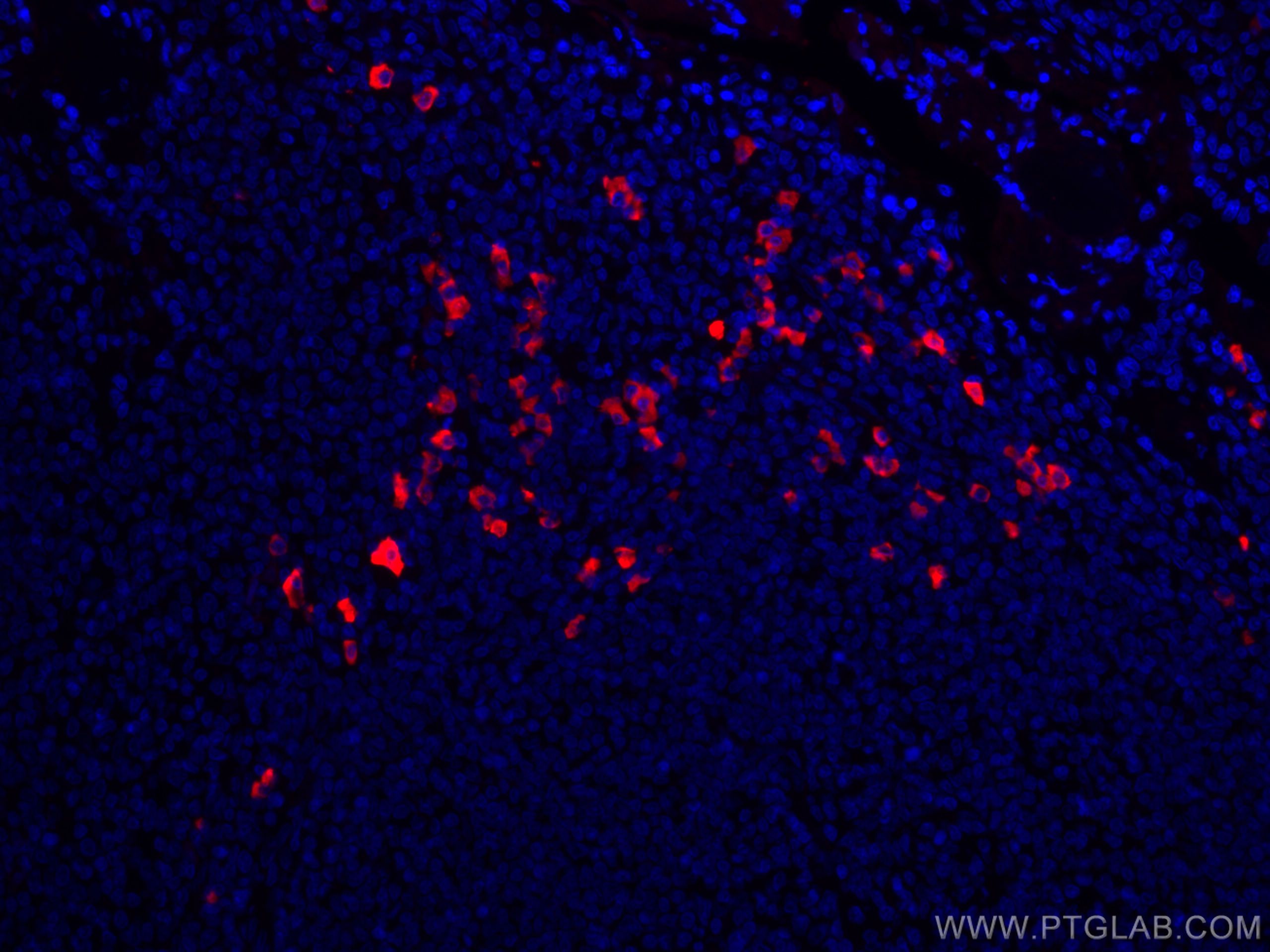 Immunofluorescence (IF) / fluorescent staining of human tonsillitis tissue using CoraLite®594-conjugated Human IgA Monoclonal antib (CL594-60099)