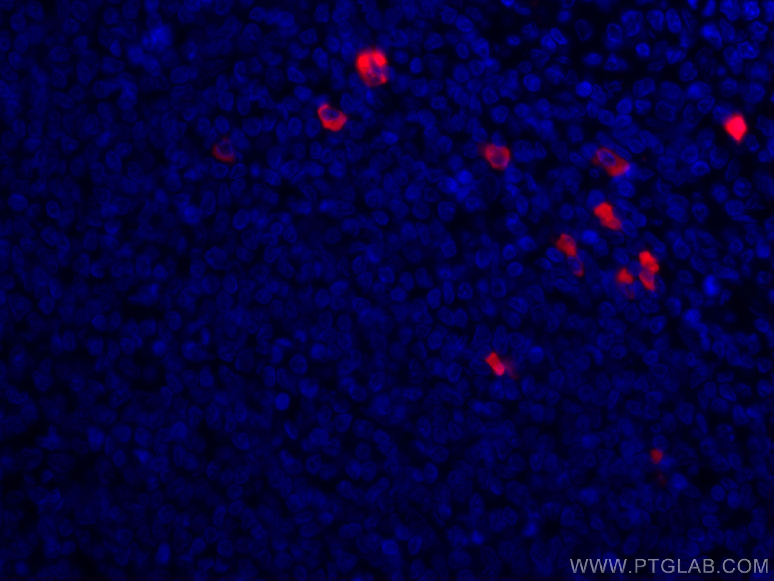 Immunofluorescence (IF) / fluorescent staining of human tonsillitis tissue using CoraLite®594-conjugated Human IgA Monoclonal antib (CL594-60099)