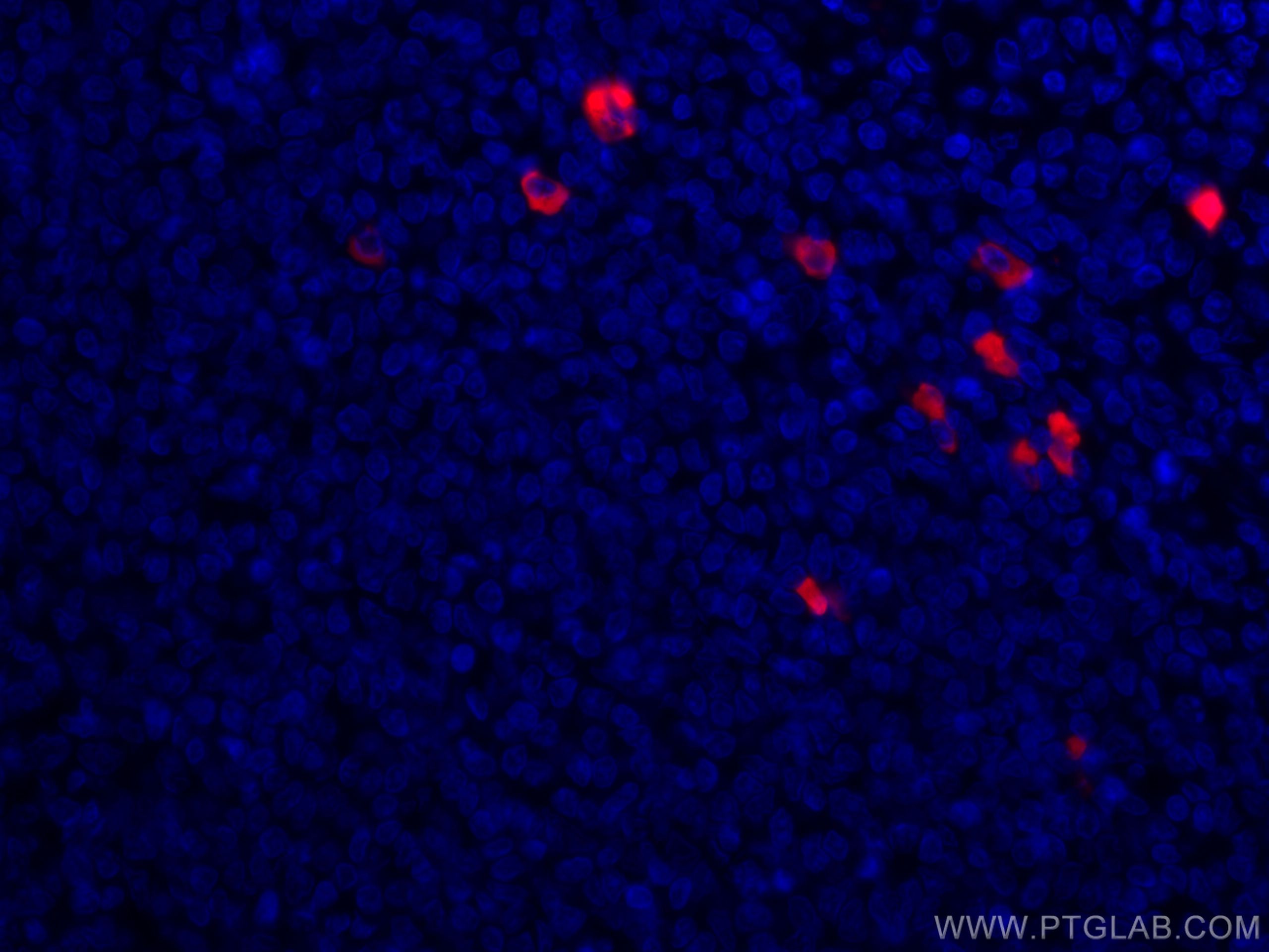 IF Staining of human tonsillitis using CL594-60099