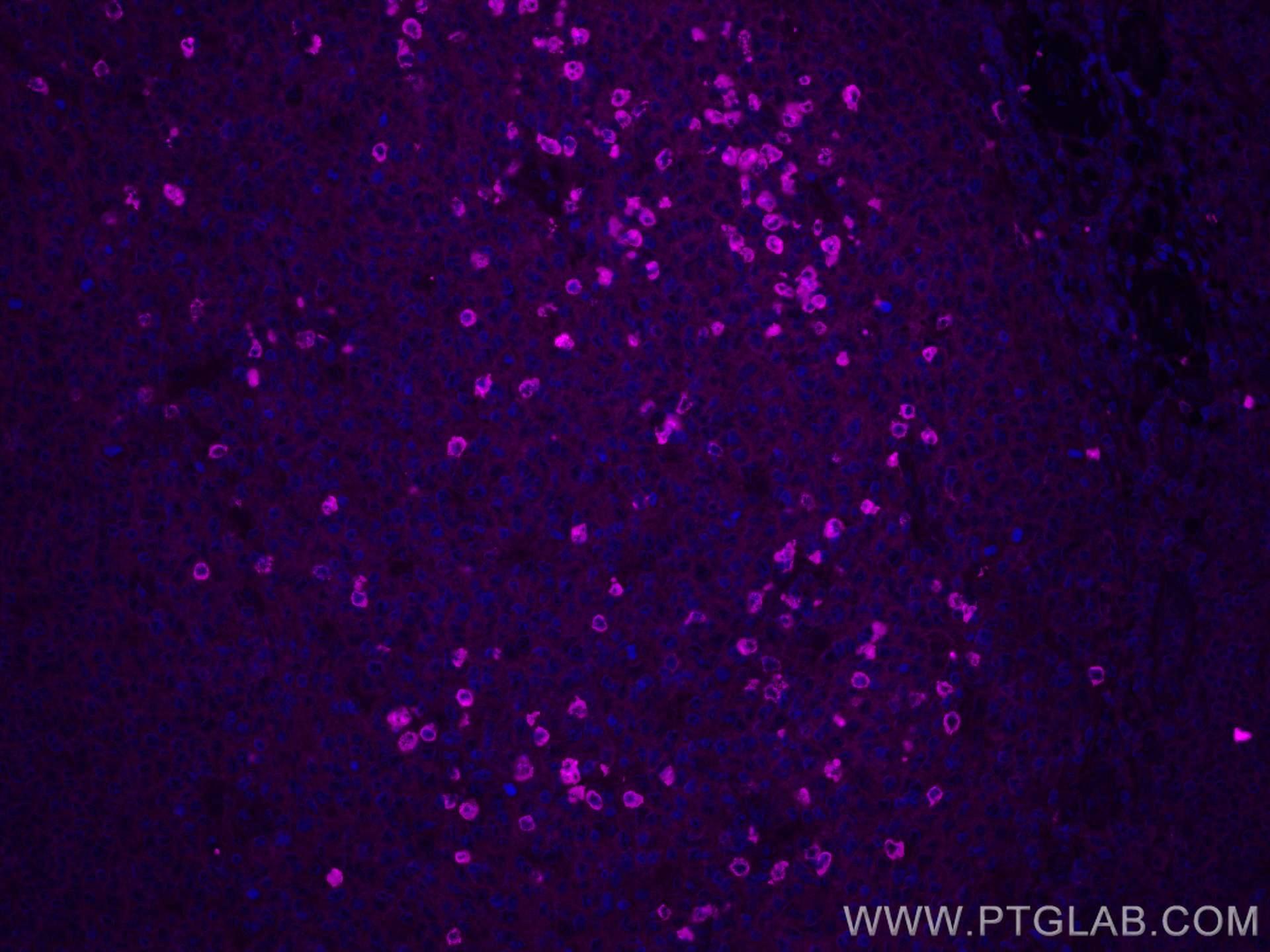 Immunofluorescence (IF) / fluorescent staining of human tonsillitis tissue using CoraLite® Plus 647-conjugated Human IgA Monoclonal (CL647-60099)