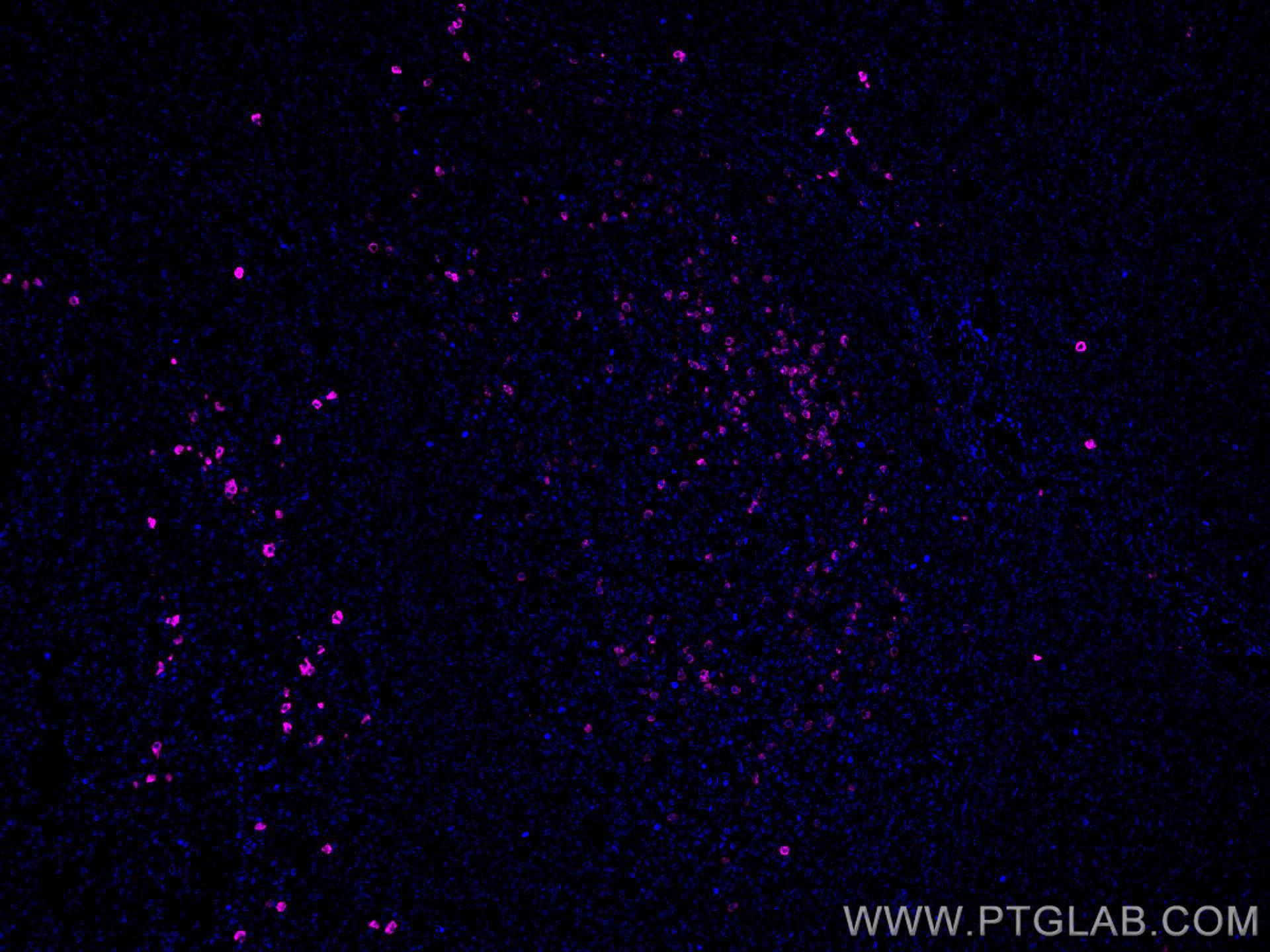 Immunofluorescence (IF) / fluorescent staining of human tonsillitis tissue using CoraLite® Plus 647-conjugated Human IgA Monoclonal (CL647-60099)