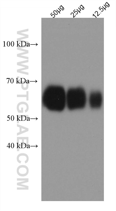 Western Blot (WB) analysis of various lysates using HRP-conjugated Human IgA Monoclonal antibody (HRP-60099)