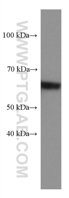 Western Blot (WB) analysis of human placenta tissue using HRP-conjugated Human IgA Monoclonal antibody (HRP-60099)