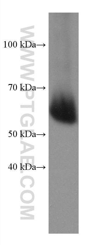 Western Blot (WB) analysis of human plasma using HRP-conjugated Human IgA Monoclonal antibody (HRP-60099)