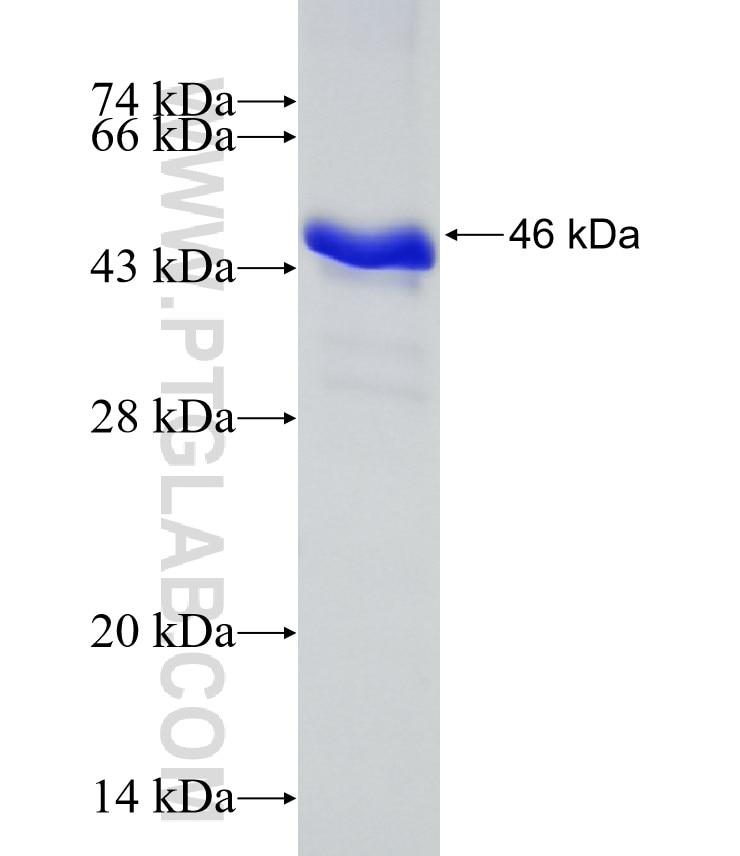 Human IgA fusion protein Ag7417 SDS-PAGE