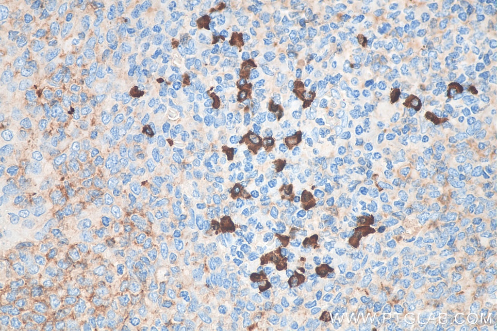 Immunohistochemistry (IHC) staining of human tonsillitis tissue using Biotin-conjugated Human IgA Heavy Chain Polyclonal (Biotin-11449)