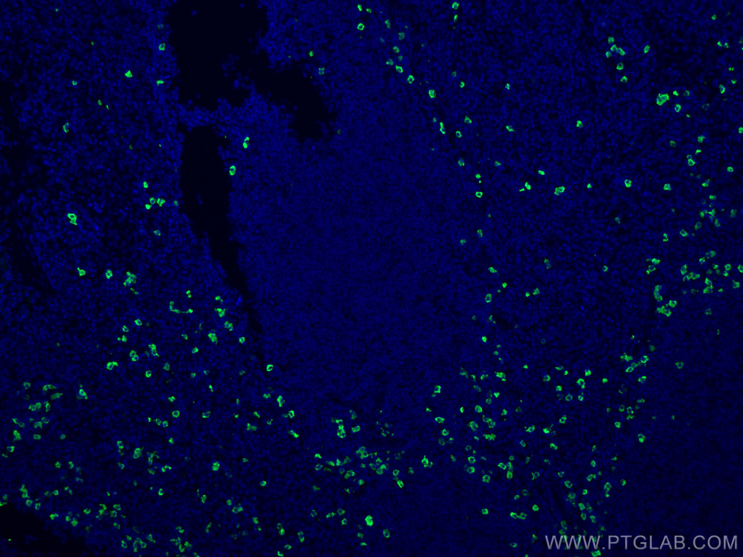 Immunofluorescence (IF) / fluorescent staining of human tonsillitis tissue using CoraLite® Plus 488-conjugated Human IgA Heavy Chai (CL488-11449)