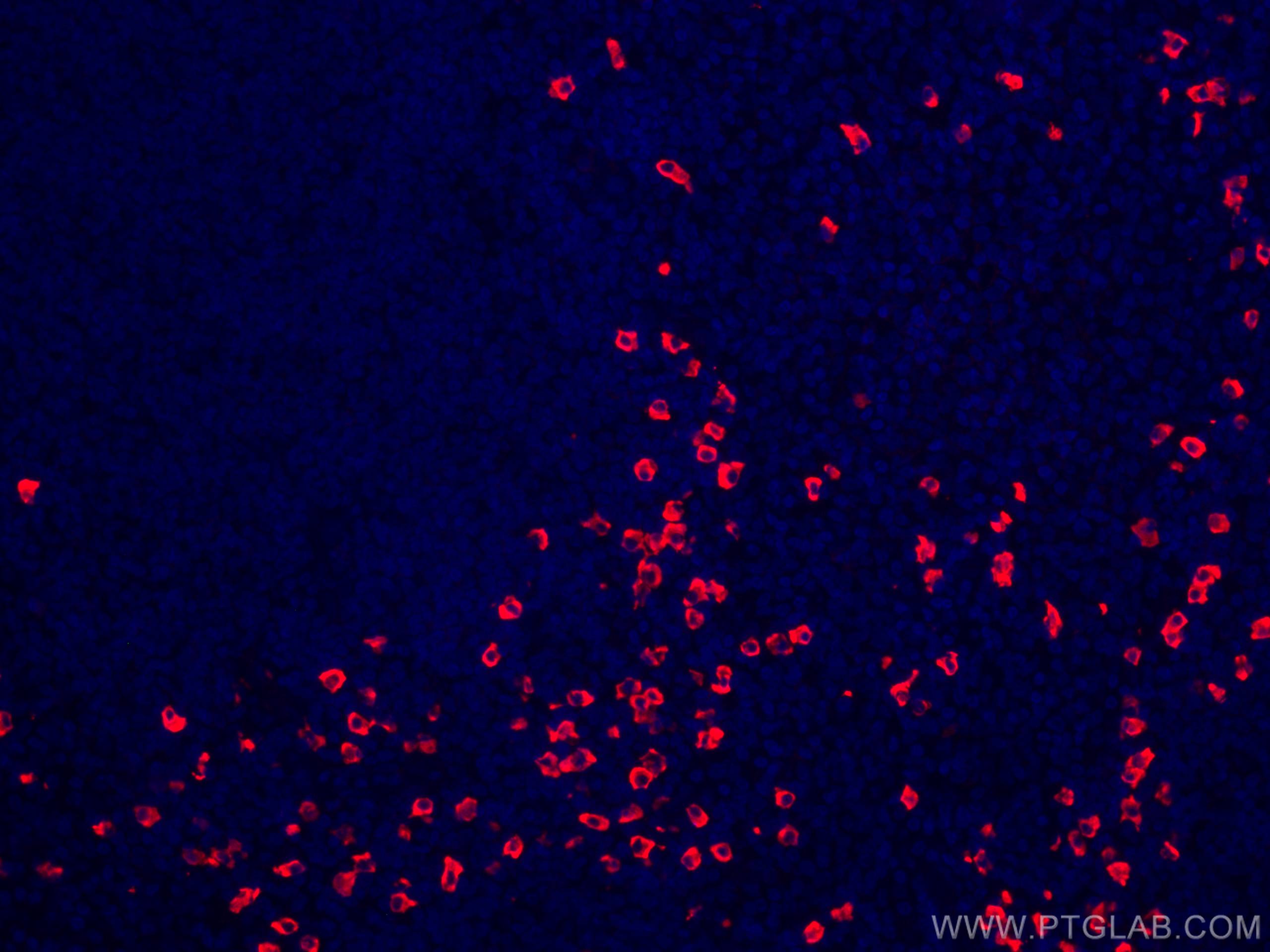 Immunofluorescence (IF) / fluorescent staining of human tonsillitis tissue using CoraLite®594-conjugated Human IgA Heavy Chain Poly (CL594-11449)