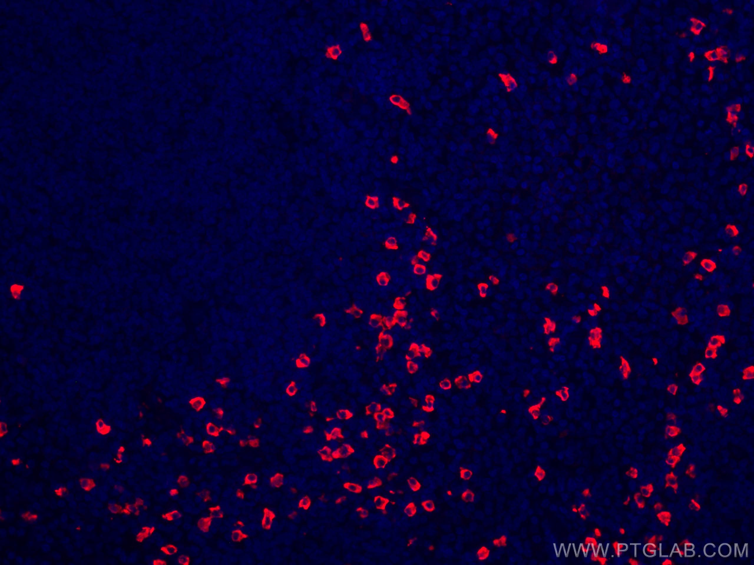 IF Staining of human tonsillitis using CL594-11449