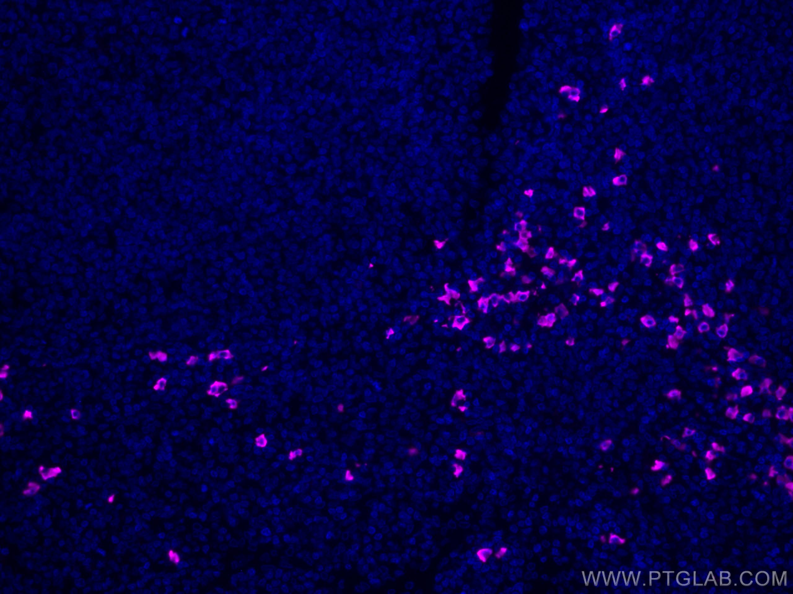 Immunofluorescence (IF) / fluorescent staining of human tonsillitis tissue using CoraLite® Plus 647-conjugated Human IgA Heavy Chai (CL647-11449)