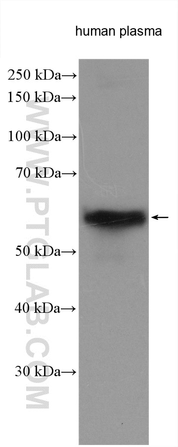 Western Blot (WB) analysis of various lysates using HRP-conjugated Human IgA Heavy Chain Polyclonal an (HRP-11449)