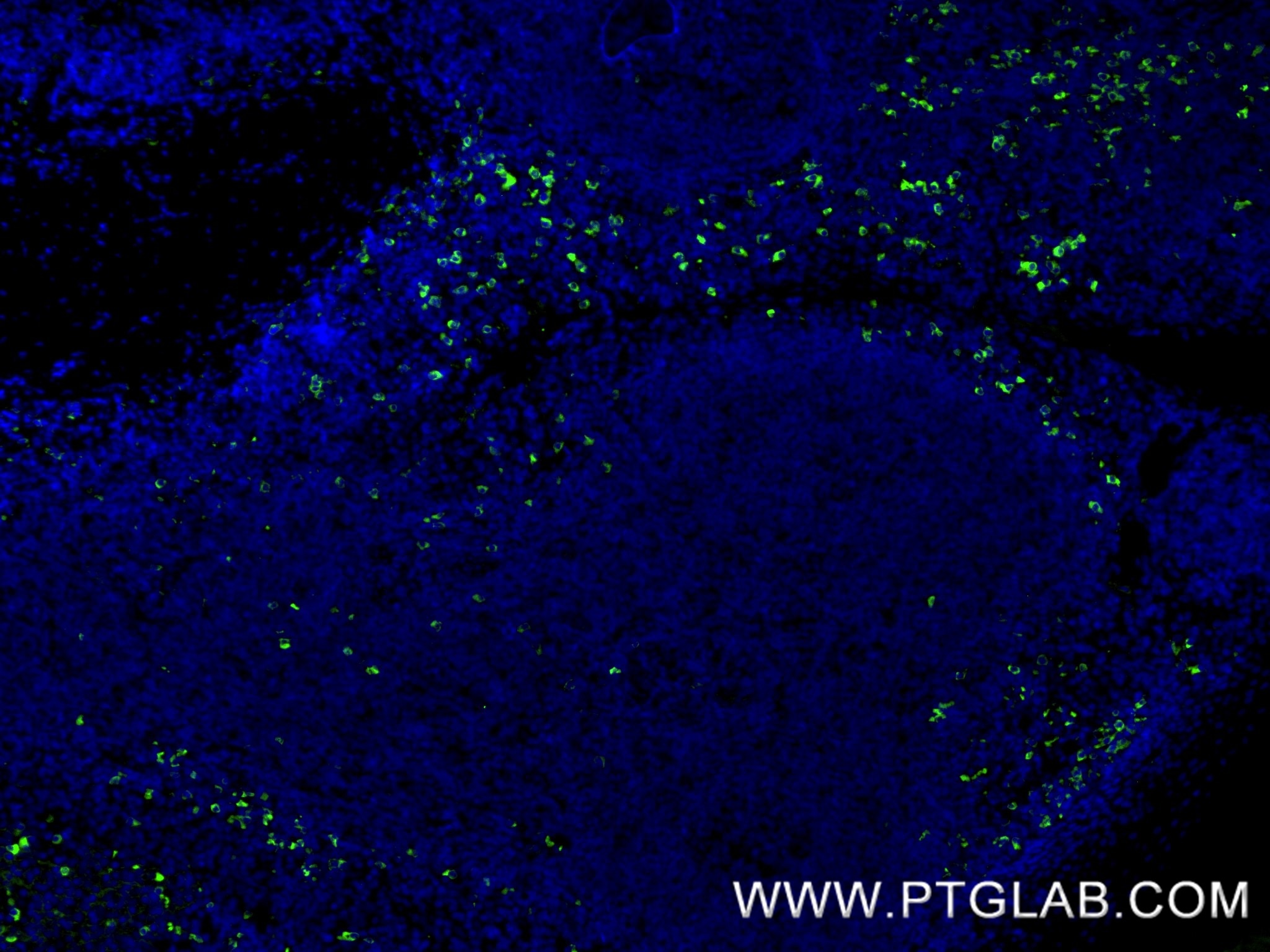 Immunofluorescence (IF) / fluorescent staining of human tonsillitis tissue using Human IgA1 Recombinant monoclonal antibody (87606-3-RR)
