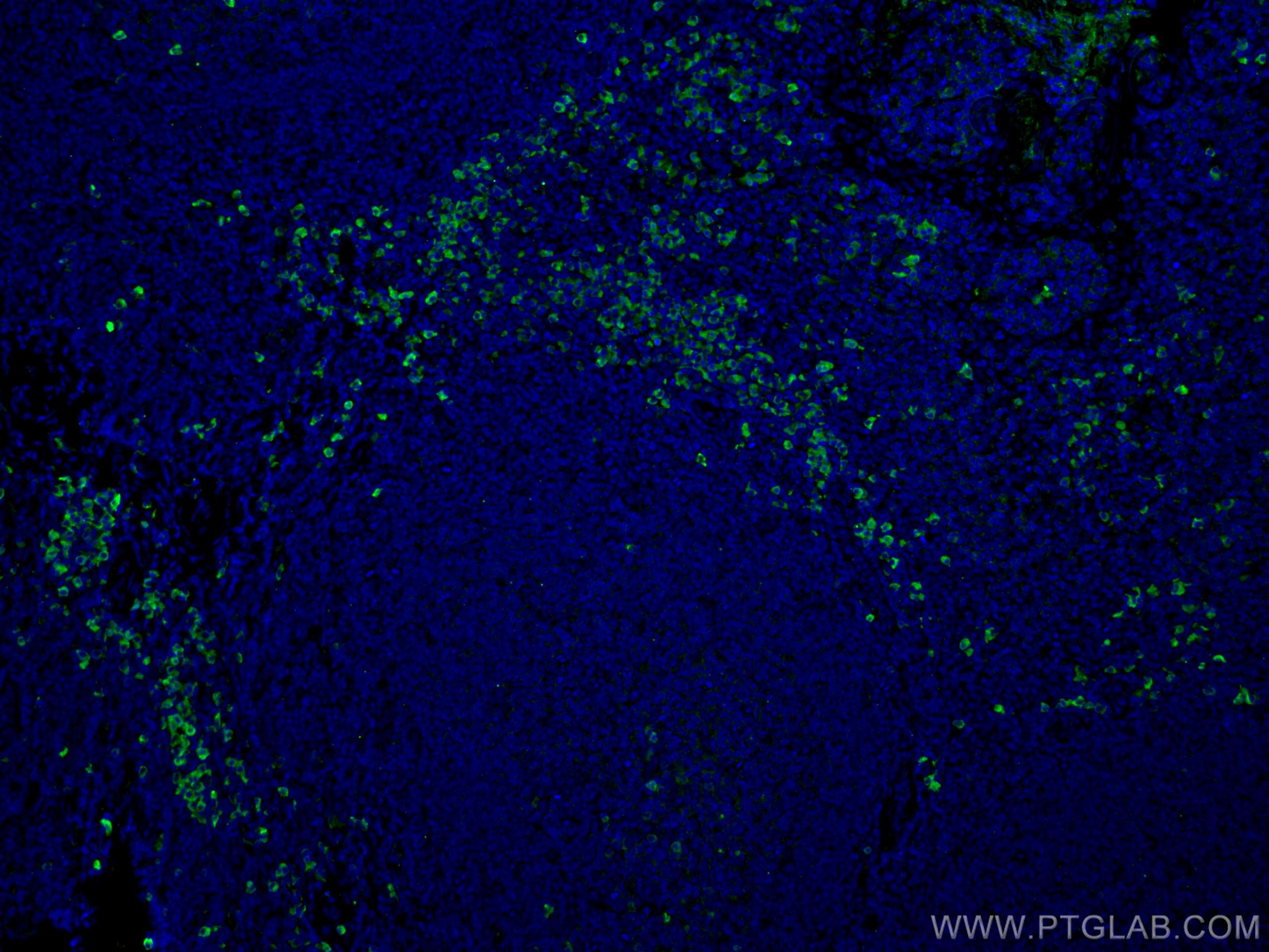 Immunofluorescence (IF) / fluorescent staining of human tonsillitis tissue using Human IgG Polyclonal antibody (10284-1-AP)