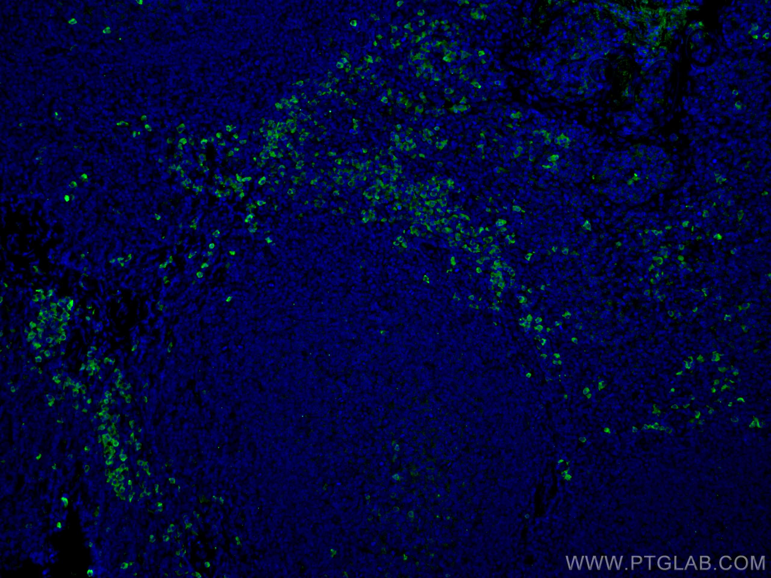 IF Staining of human tonsillitis using 10284-1-AP