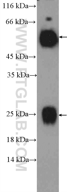 Western Blot (WB) analysis of human plasma using Human IgG Polyclonal antibody (10284-1-AP)