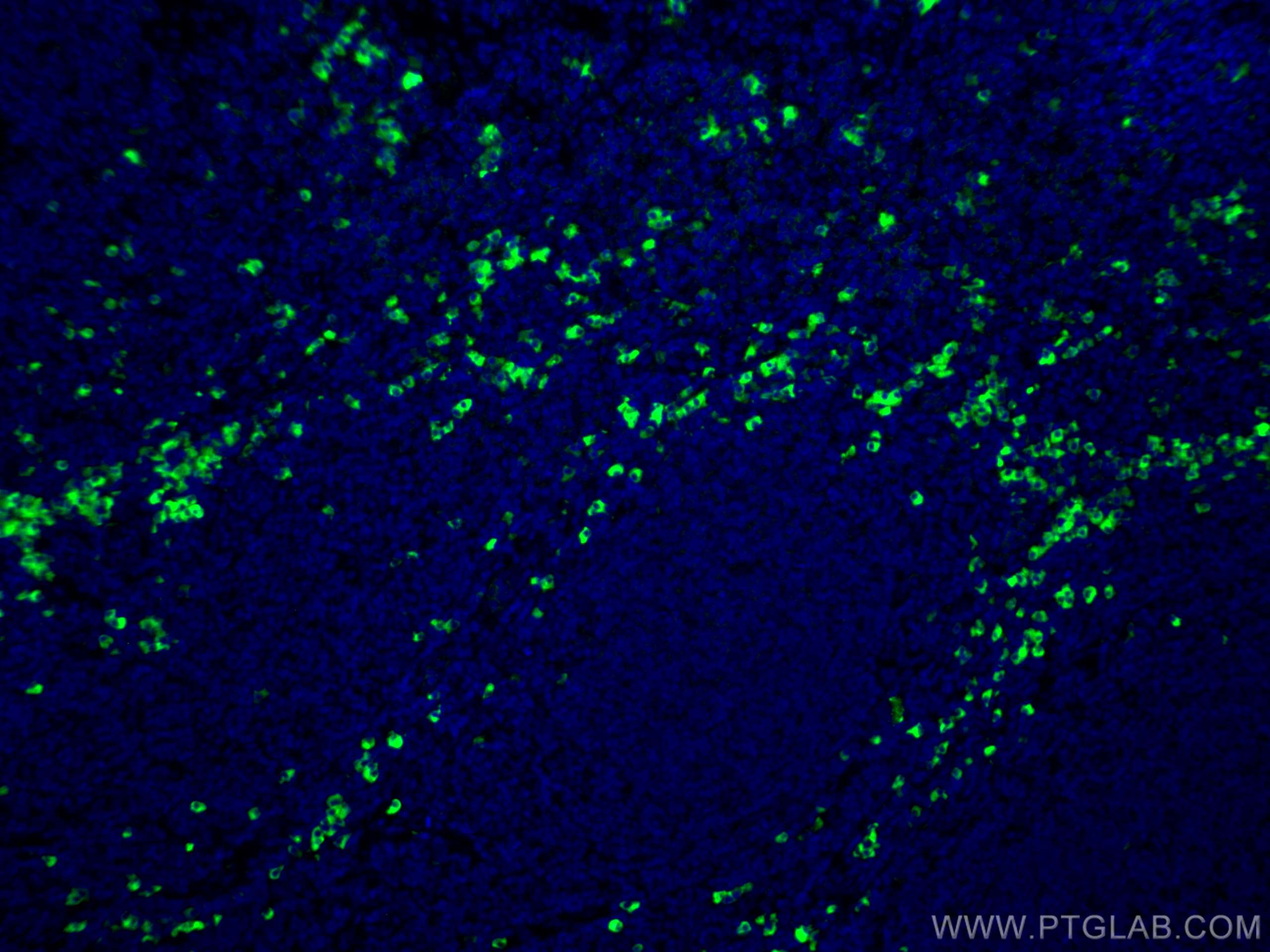 Immunofluorescence (IF) / fluorescent staining of human tonsillitis tissue using CoraLite® Plus 488-conjugated Human IgG Polyclonal (CL488-10284)