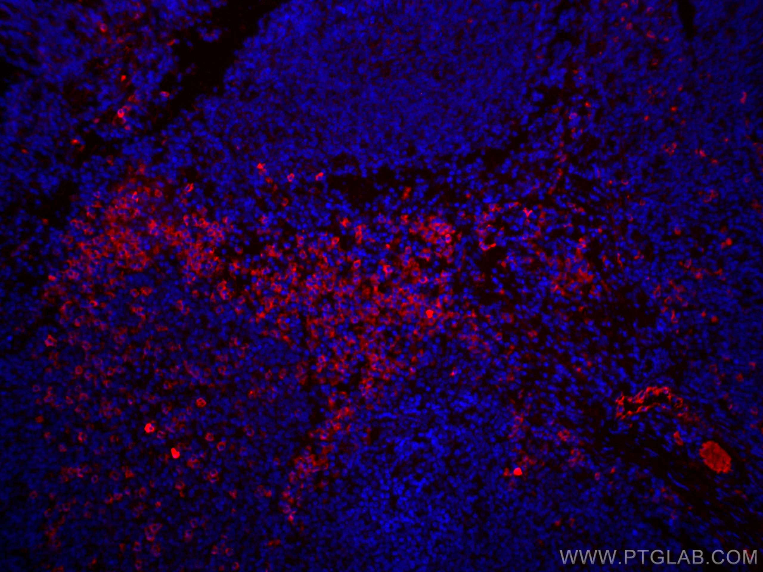 Immunofluorescence (IF) / fluorescent staining of human tonsillitis tissue using CoraLite®594-conjugated Human IgG Polyclonal antib (CL594-10284)
