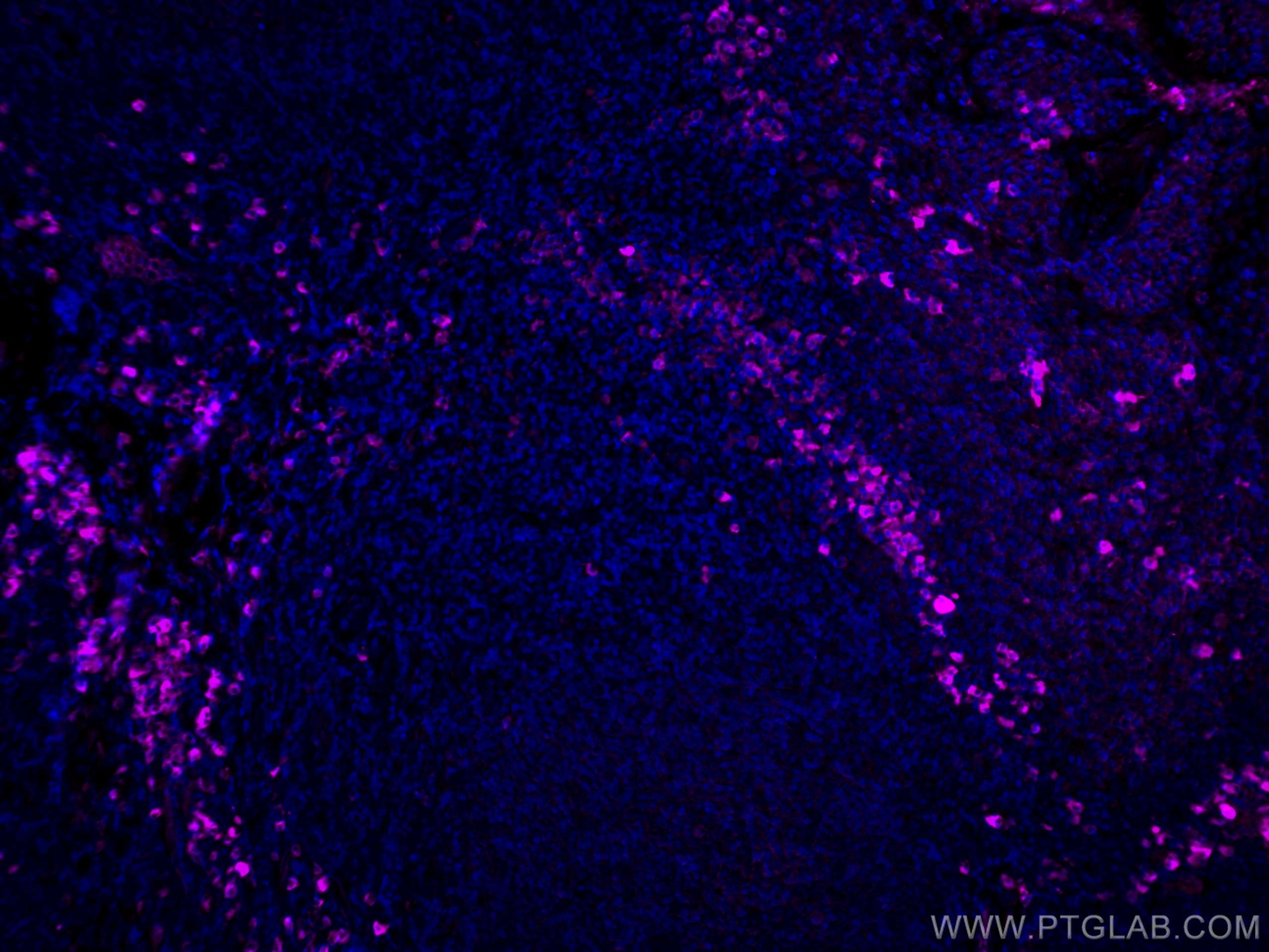 Immunofluorescence (IF) / fluorescent staining of human tonsillitis tissue using CoraLite® Plus 647-conjugated Human IgG Polyclonal (CL647-10284)