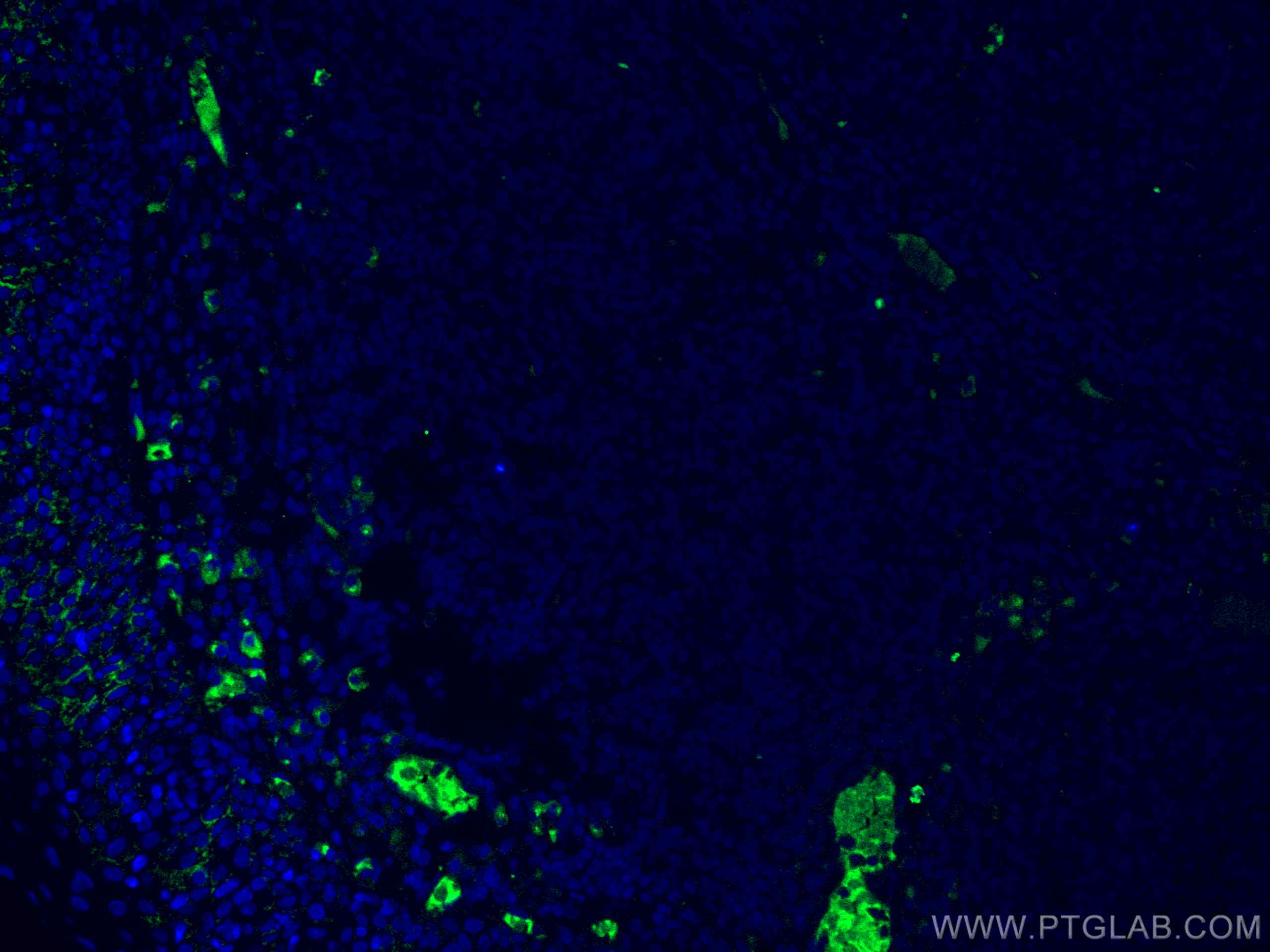 Immunofluorescence (IF) / fluorescent staining of human tonsillitis tissue using Human IgG Heavy chain Monoclonal antibody (67760-1-Ig)