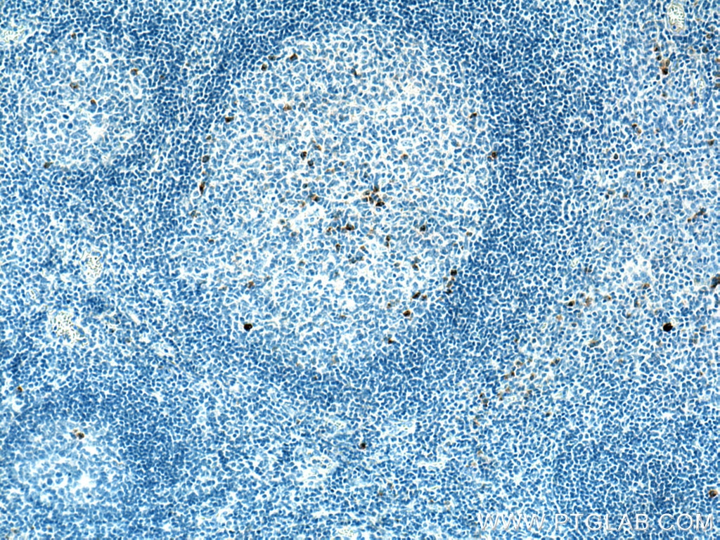 Immunohistochemistry (IHC) staining of human tonsillitis tissue using Human IgG Heavy chain Monoclonal antibody (67760-1-Ig)