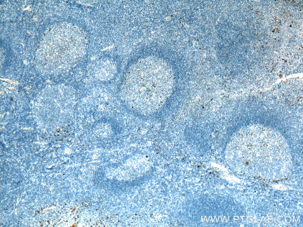 Immunohistochemistry (IHC) staining of human tonsillitis tissue using Human IgG Heavy chain Monoclonal antibody (67760-1-Ig)