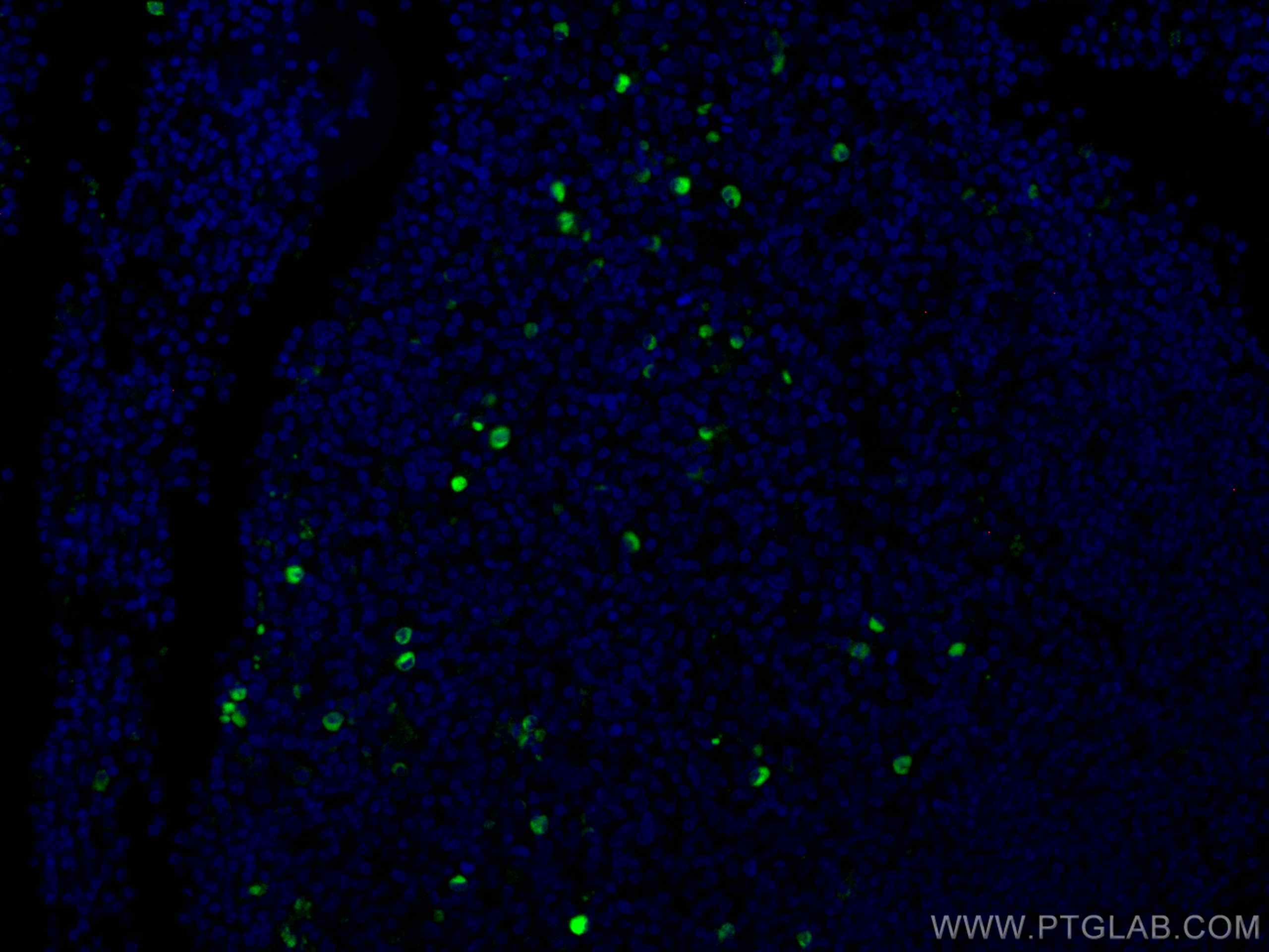 Immunofluorescence (IF) / fluorescent staining of human tonsillitis tissue using CoraLite® Plus 488-conjugated Human IgG Heavy chai (CL488-67760)