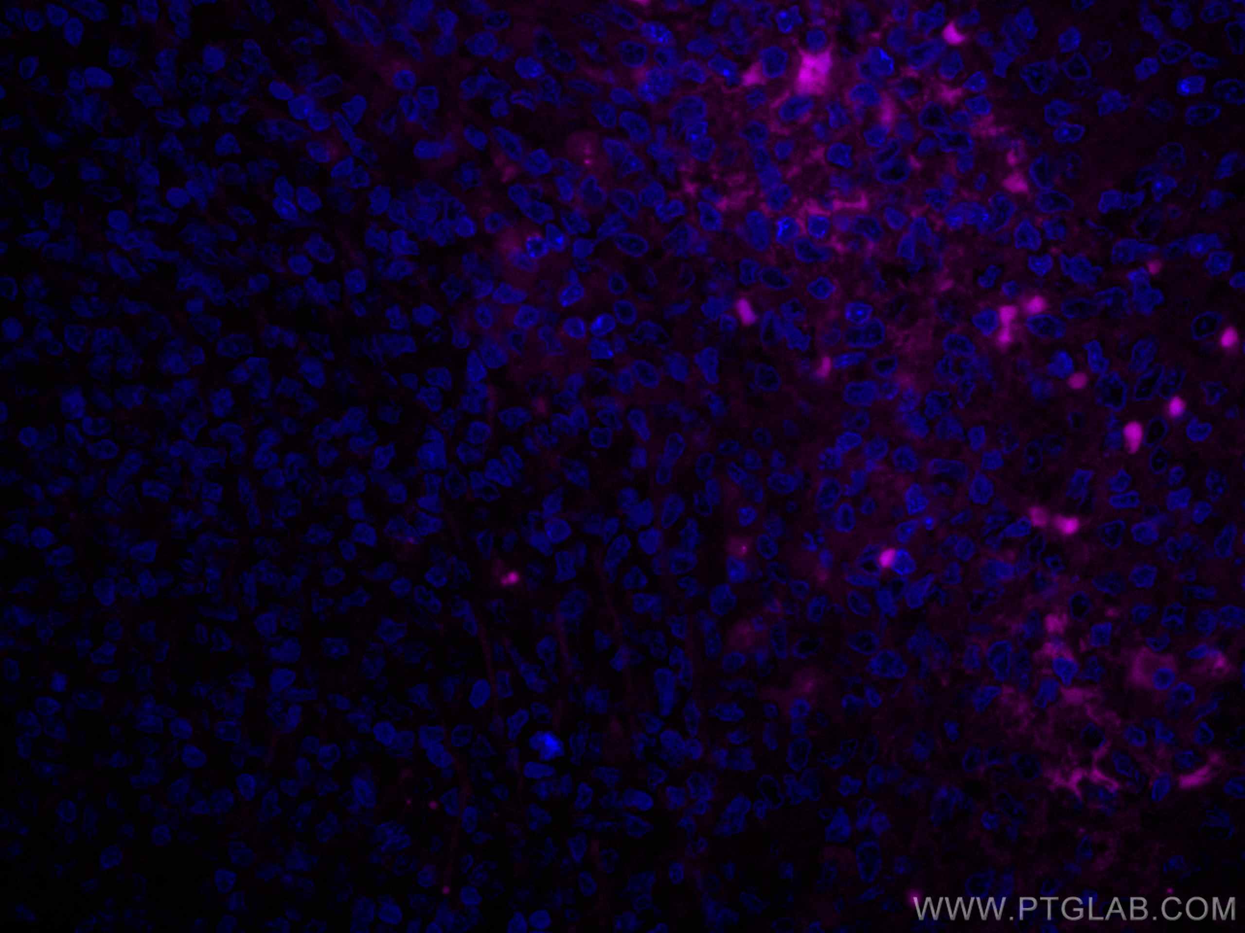 Immunofluorescence (IF) / fluorescent staining of human tonsillitis tissue using CoraLite® Plus 647-conjugated Human IgG Heavy chai (CL647-67760)