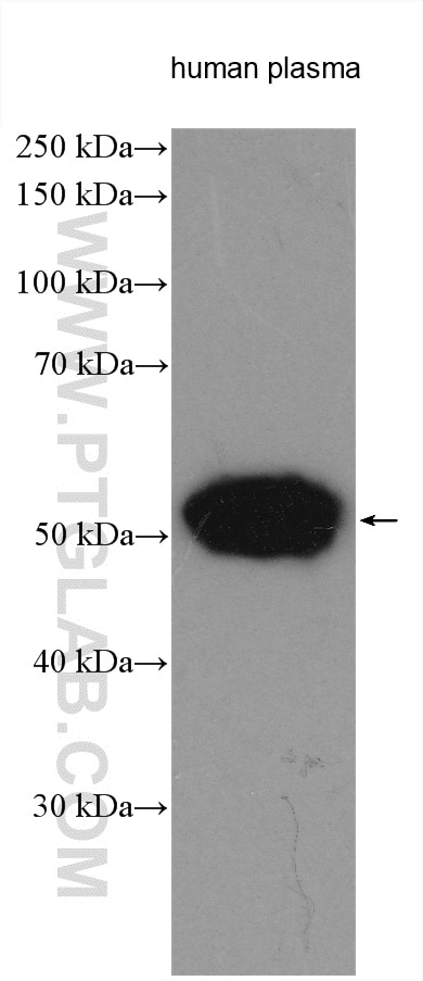 Western Blot (WB) analysis of various lysates using HRP-conjugated Human IgG Heavy chain Monoclonal an (HRP-67760)