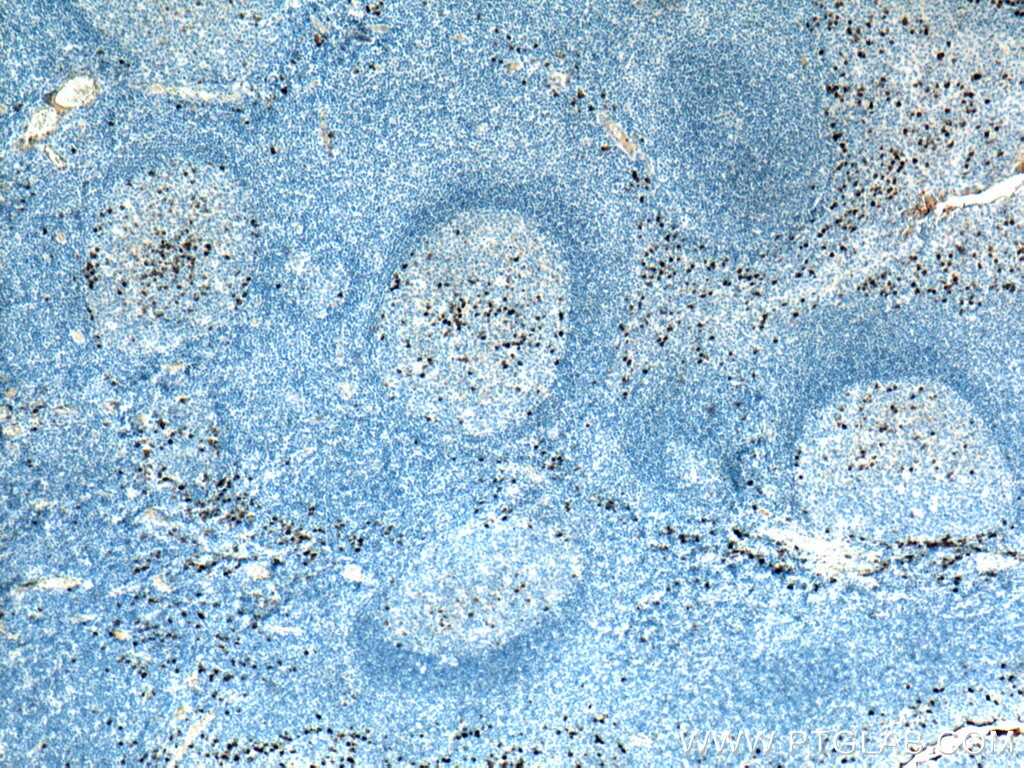 Immunohistochemistry (IHC) staining of human tonsillitis tissue using Human IgG Kappa chain Monoclonal antibody (67761-1-Ig)