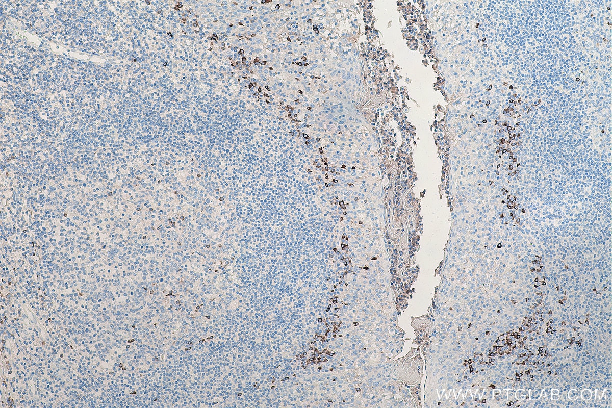 Immunohistochemistry (IHC) staining of human tonsillitis tissue using Human IgG Kappa chain Monoclonal antibody (67761-1-Ig)
