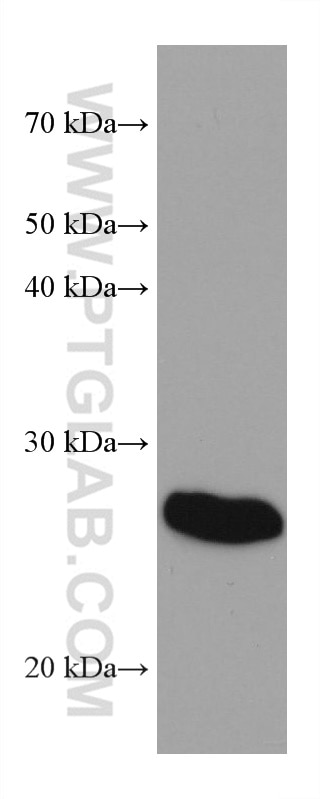 WB analysis of human plasma using 67761-1-Ig