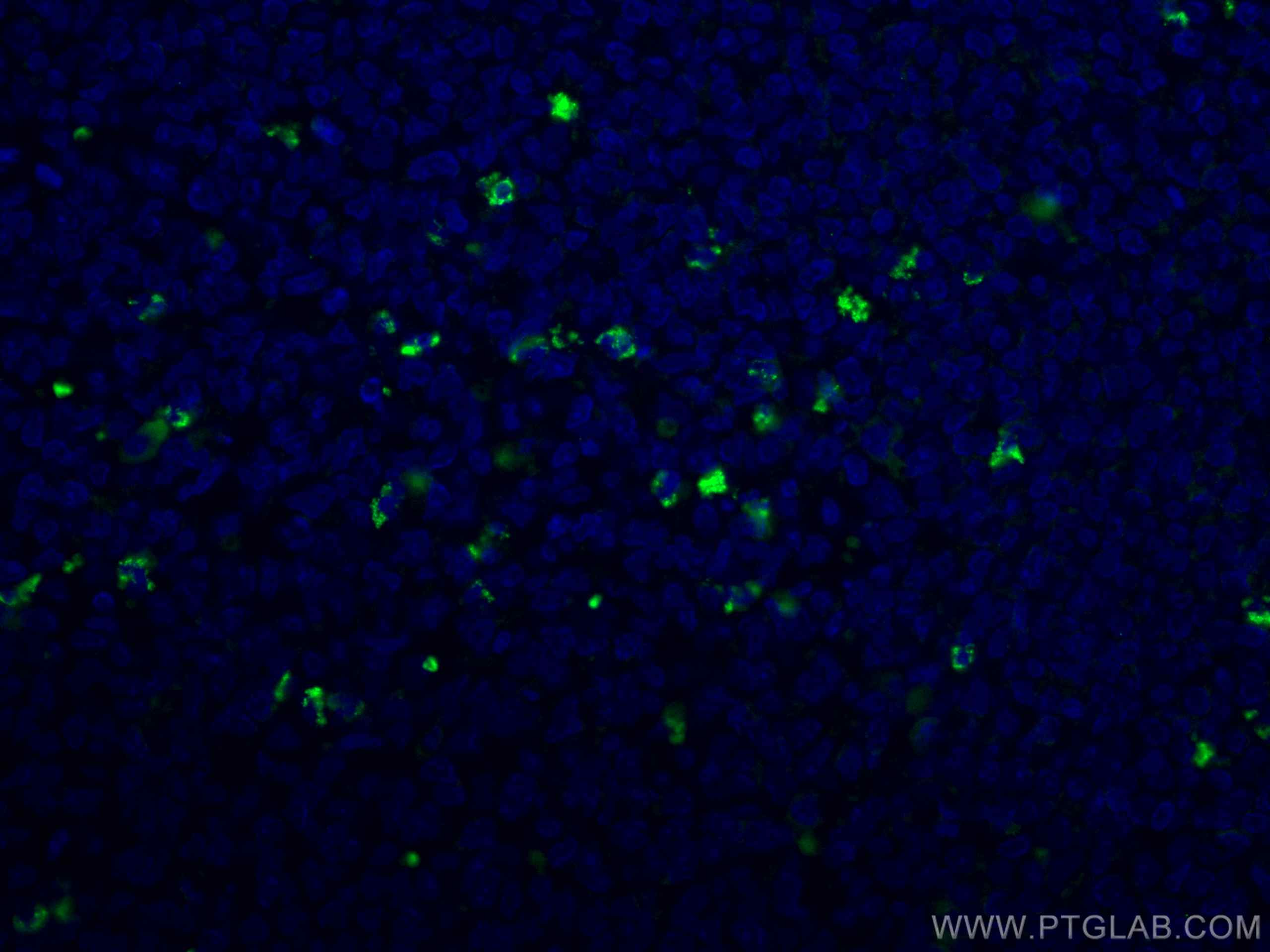 Immunofluorescence (IF) / fluorescent staining of human tonsillitis tissue using CoraLite® Plus 488-conjugated Human IgG Kappa chai (CL488-67761)