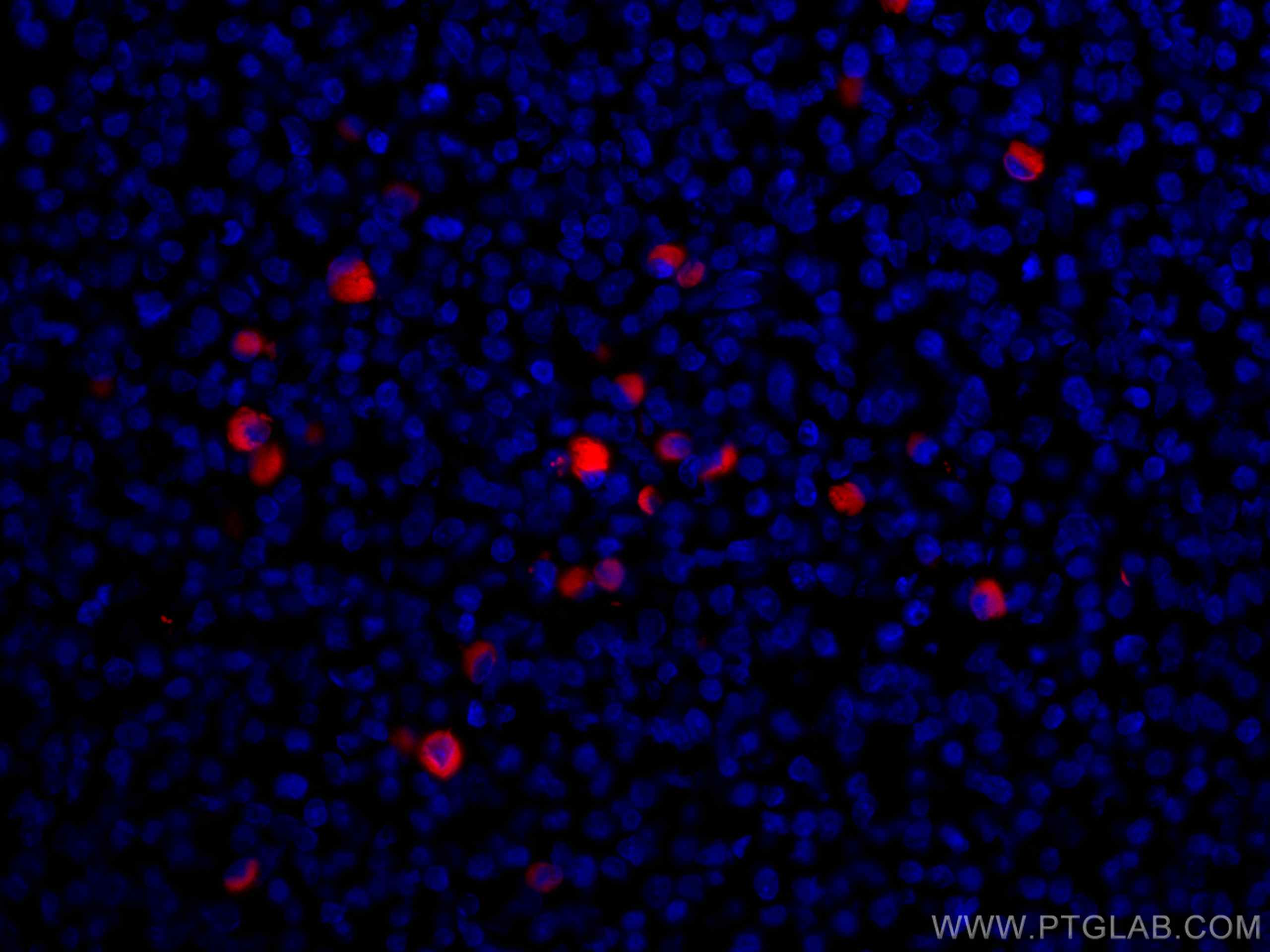 Immunofluorescence (IF) / fluorescent staining of human tonsillitis tissue using CoraLite®594-conjugated Human IgG Kappa chain Mono (CL594-67761)