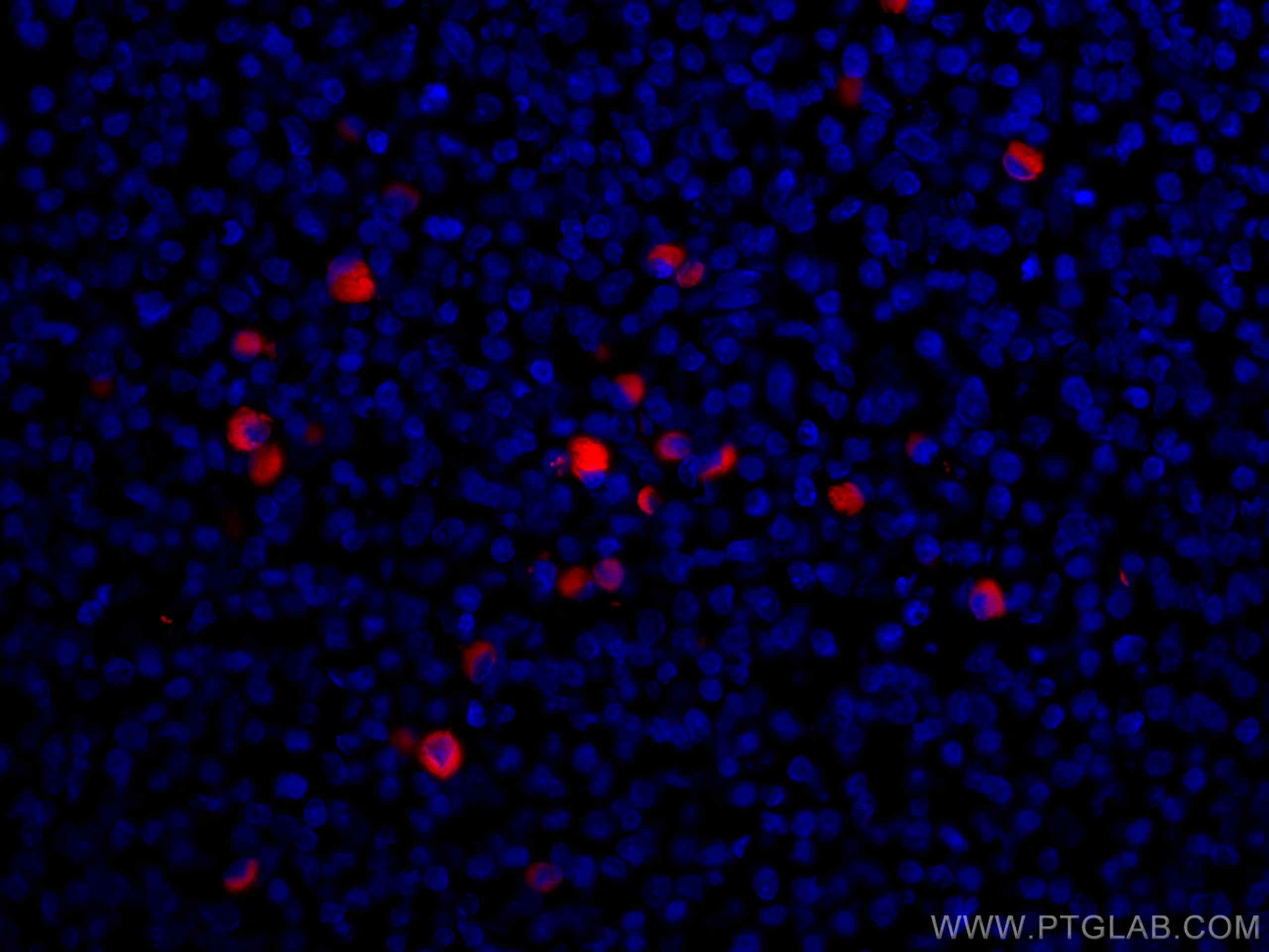 IF Staining of human tonsillitis using CL594-67761